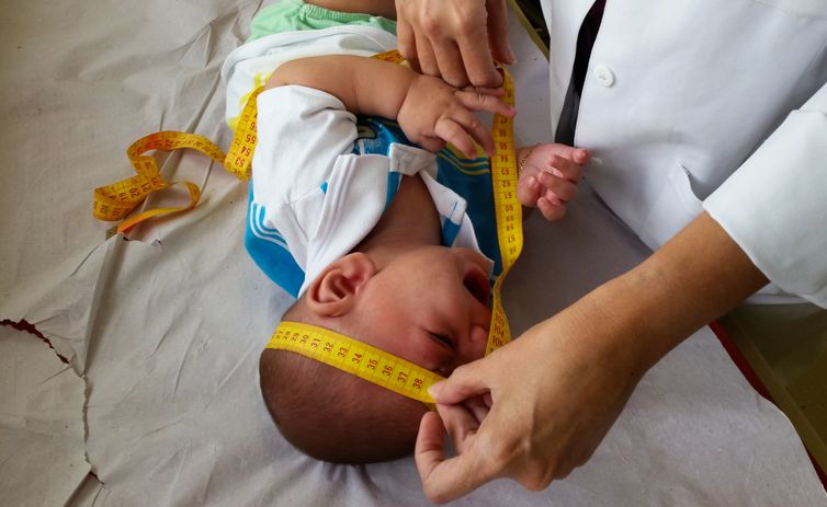 Bebê com microcefalia