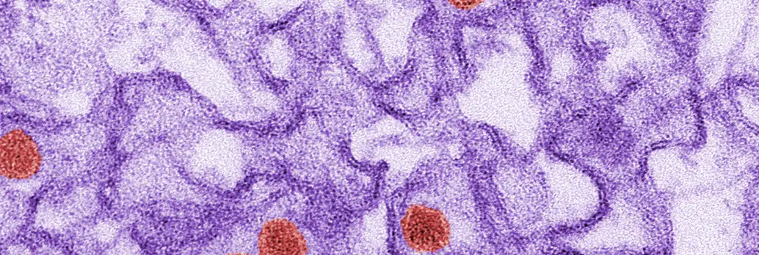 Zika vírus O vírus Zika