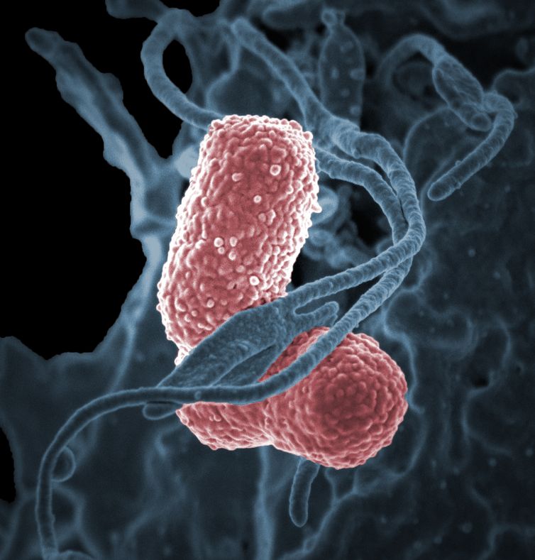 Imagem de bactéria Klebsiella pneumoniae feita por microscópio eletrônico e colorizada por computador, mostrando a bactéria Klebsiella pneumoniae interagindo com uma célula humana