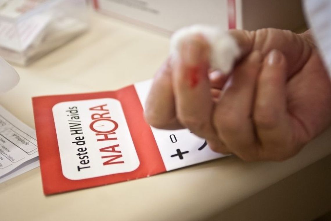 Tempo de vida de pessoas com HIV mais que dobra no Brasil