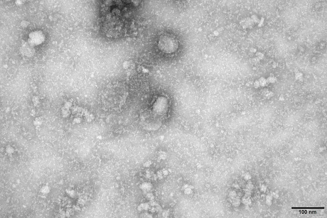 Imagem de microscopia eletrônica de transmissão do primeiro caso isolado do coronavírus Reuters / Direitos Reservados.  