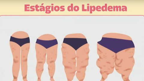 capa do episódio