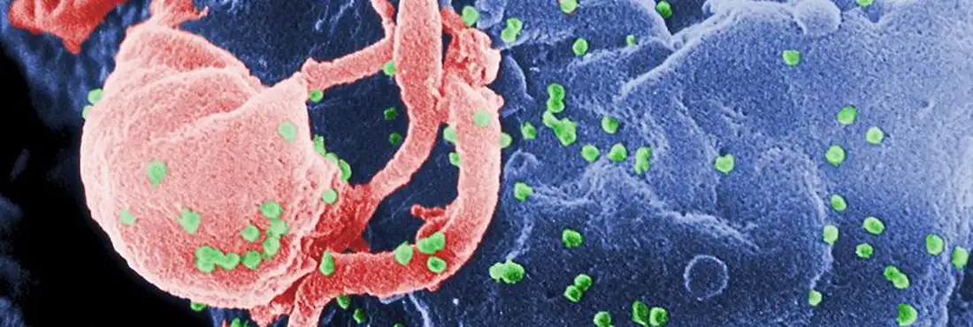 HIV Aumento do uso de antirretrovirais em países de baixo e médio rendimento permitiu salvar 14 milhões de vidas por ano desde 1995
