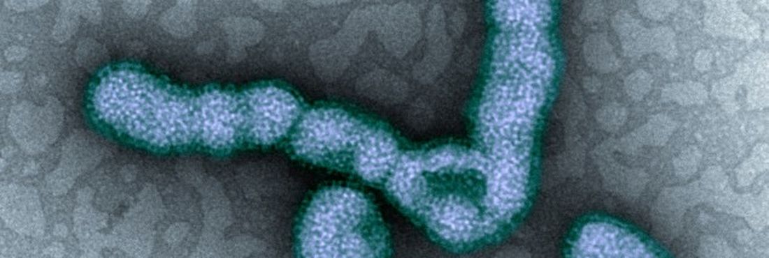 Vírus H1N1 Imagem mostra partículas do vírus H1N1