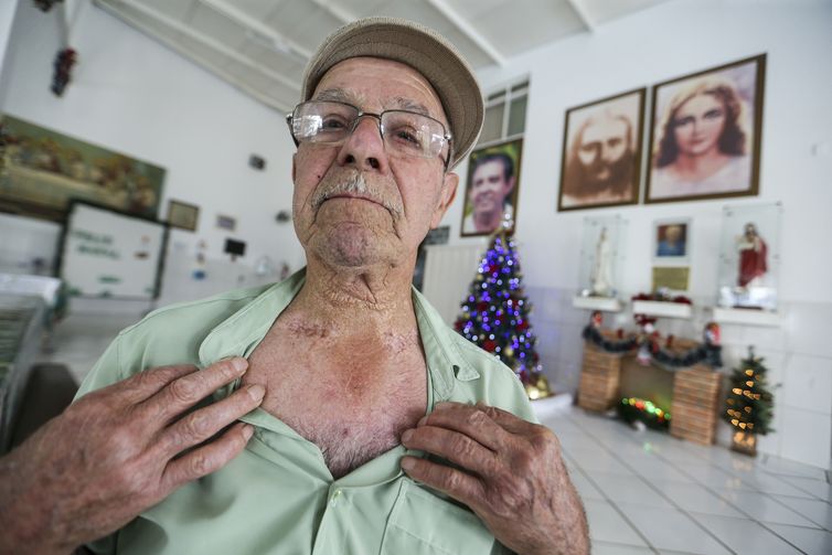  Joaquim Pedro de Menezes mostra cicatrizes de cirurgia espiritual para cura de um câncer na garganta realizada por João de Deus na Casa Dom Inácio Loyola, em Abadiânia.  