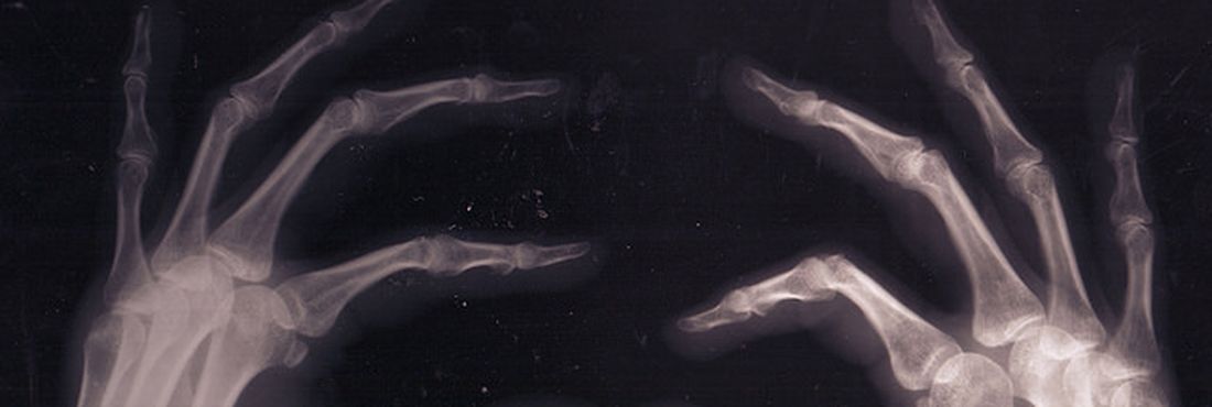 Radiografia de mãos