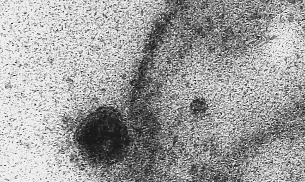 microscopia eletrônica; célula  coronavírus; sars-cov-2