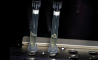 Amostras suspeitas de varíola dos macacos em laboratório de microbiologia em Madri