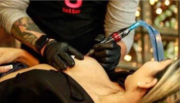 Projeto Y faz tatuagem para a reconstrução da aréola de mulheres que passaram por mastectomia.