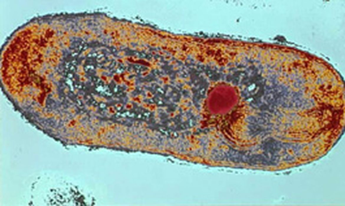 Lâmina com os bacilos da tuberculose