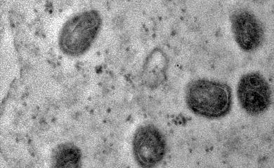 03_A varíola dos macacos é transmitida pelo vírus monkeypox, que pertence ao gênero orthopoxvirus