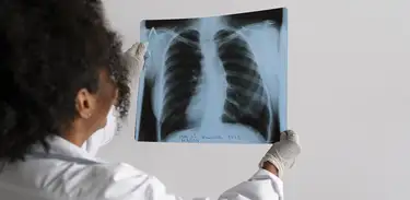 Médica observa radiografia de pulmão