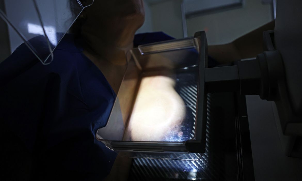 Brasília (DF), 01/10/2024 - Teste de mamografia realizado na Campanha Outubro Rosa: Sesc-DF, que oferece exames e consultas gratuitas às mulheres.  Foto: José Cruz/Agência Brasil
