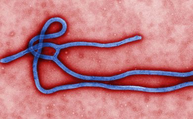 Ebola virus virion. Created by GC microbiologist Cynthia Goldsmith
