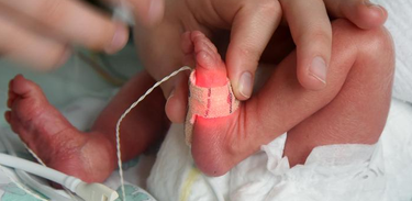 Futurando fala sobre tecnologia que ajuda na respiração de bebês prematuros
