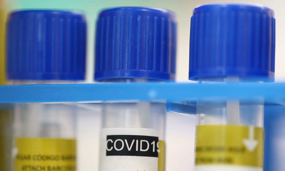 .Ministério da Saúde vai mudar protocolo e aumentar testagem para coronavírus