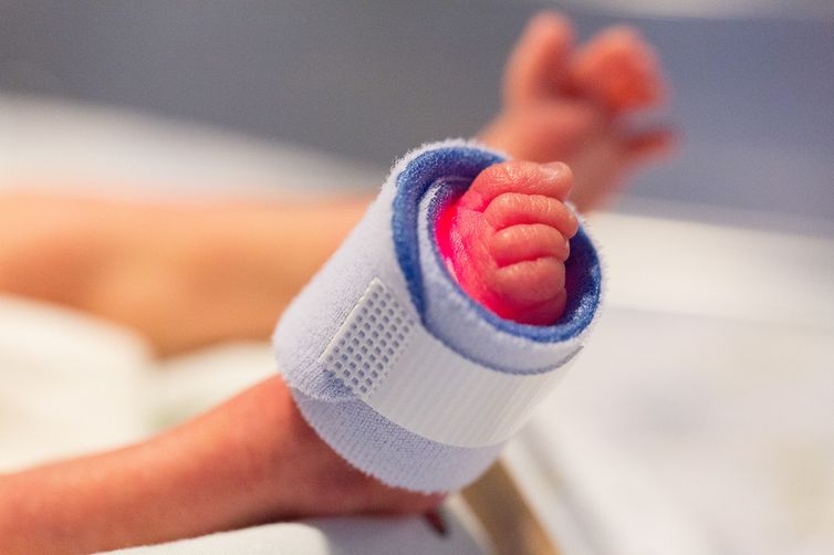 A prematuridade é uma das principais causas de morte de bebês