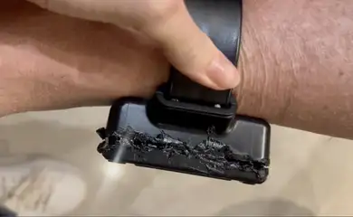 Brasília (DF), 22/11/2025 - Tornozeleira do ex-presidente Jair Bolsonaro com marcas de tentativa de violação. Foto: SEAP/Divulgação