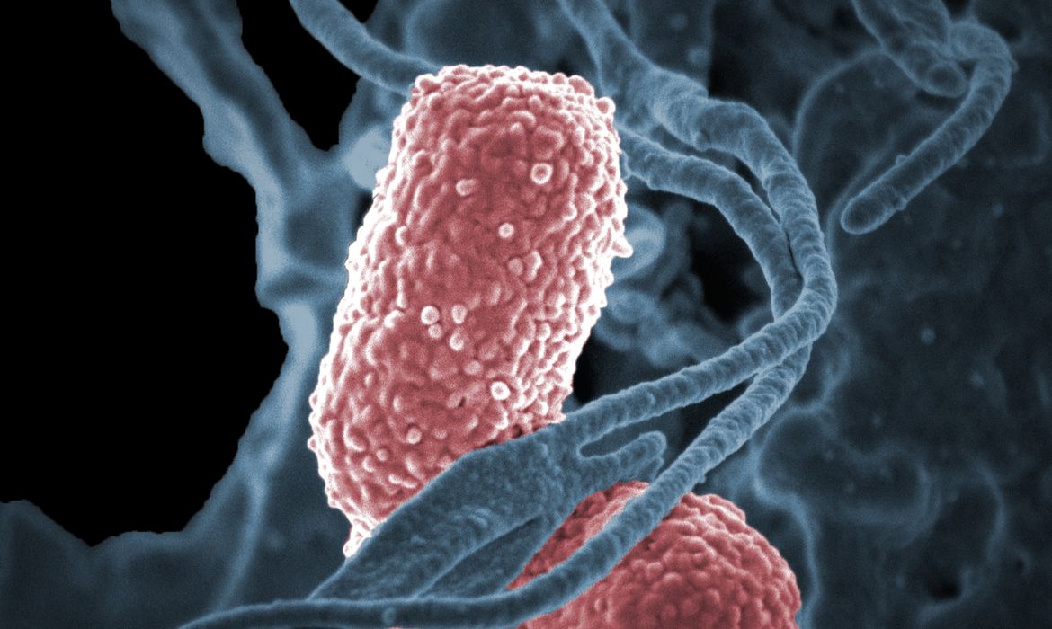 Imagem de bactéria Klebsiella pneumoniae feita por microscópio eletrônico e colorizada por computador, mostrando a bactéria Klebsiella pneumoniae interagindo com uma célula humana