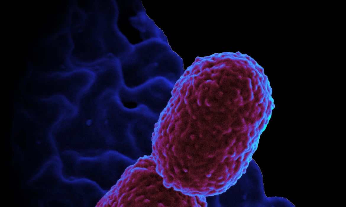 Imagem feita por microscópio eletrônico e colorizada por computador, mostrando a bactéria Klebsiella pneumoniae interagindo com uma célula humana