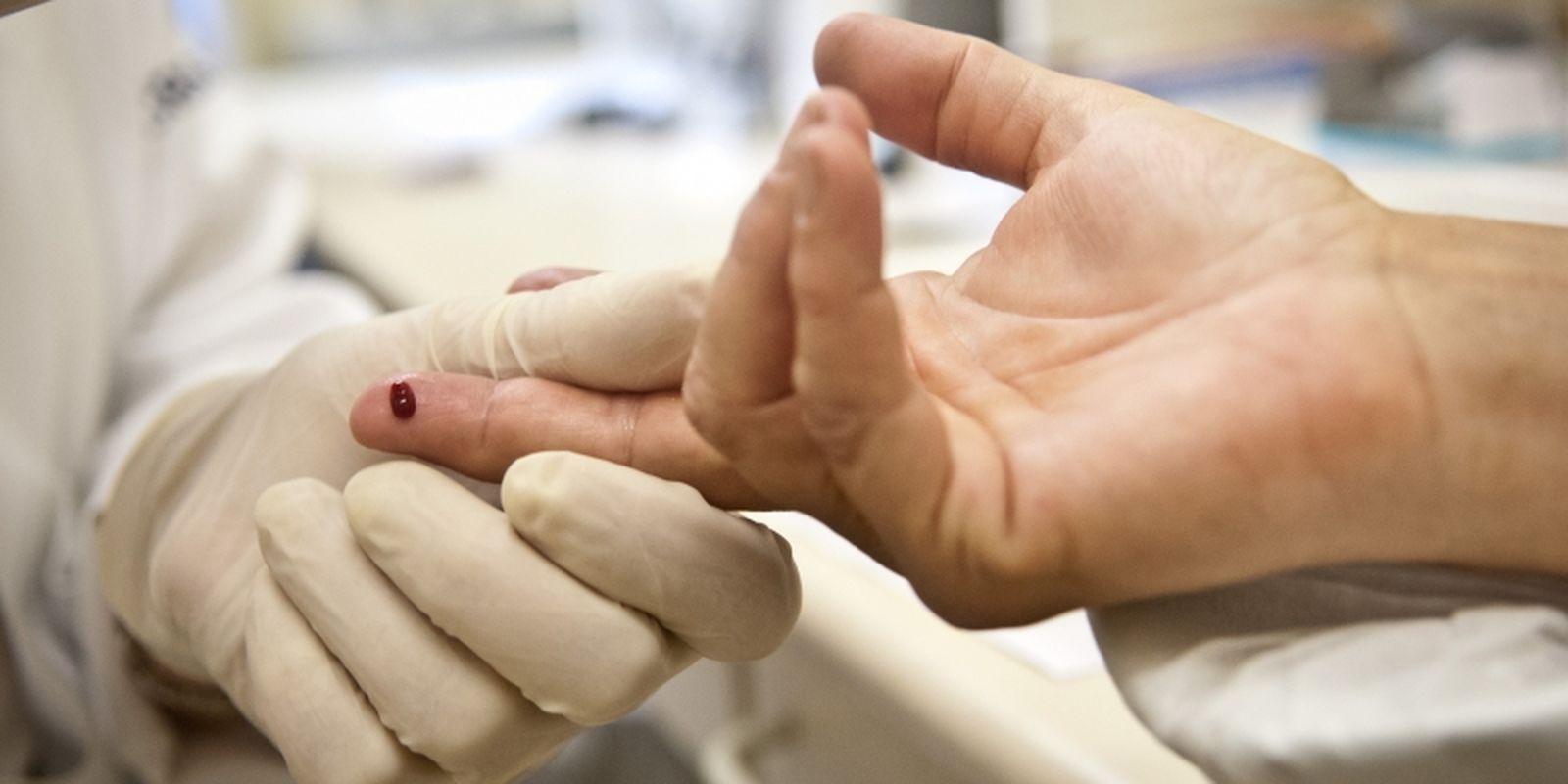 Casos de sífilis e de HIV/aids aumentam entre homens jovens Casos de sífilis e de HIV/aids aumentam entre homens jovens