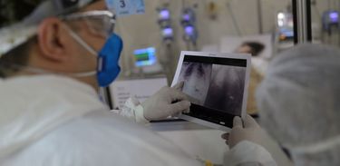 Radiografia tórax pulmão no Hospital São Paulo 