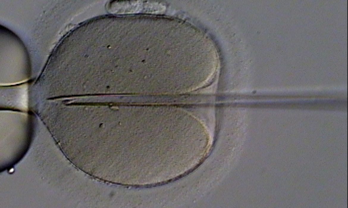 A injeção intracitoplasmática é uma técnica de reprodução assistida