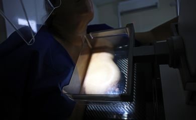 Brasília (DF), 01/10/2024 - Teste de mamografia realizado na Campanha Outubro Rosa: Sesc-DF, que oferece exames e consultas gratuitas às mulheres.  Foto: José Cruz/Agência Brasil