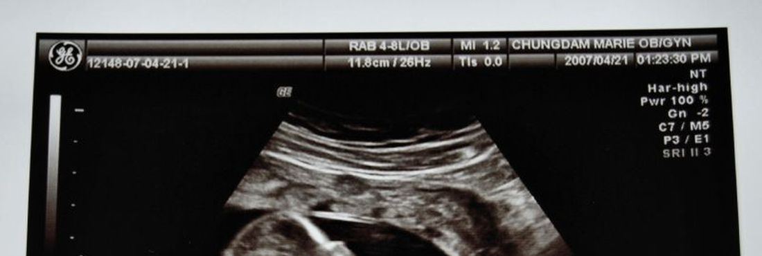 Imagem de ultrassom