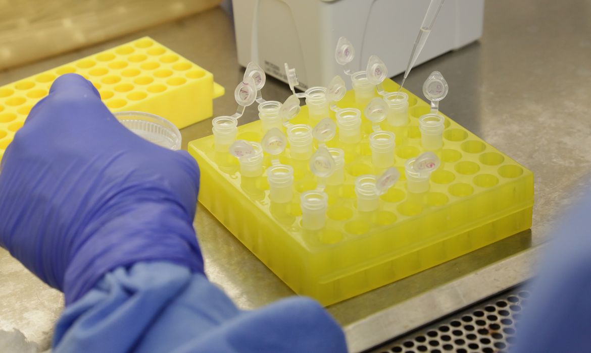 Diagnóstico laboratorial de casos suspeitos do novo coronavírus (2019-nCoV), realizado pelo Laboratório de Vírus Respiratório e do Sarampo do Instituto Oswaldo Cruz (IOC/Fiocruz), que atua como Centro de Referência Nacional em Vírus