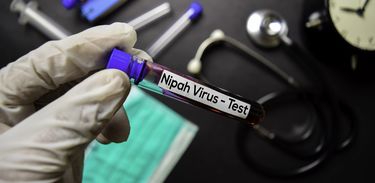 Mão segurando tubo com exame positivo para o vírus Nipah