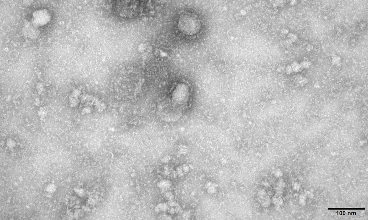 Imagem de microscopia eletrônica de transmissão do primeiro caso isolado do coronavírus Reuters / Direitos Reservados.  