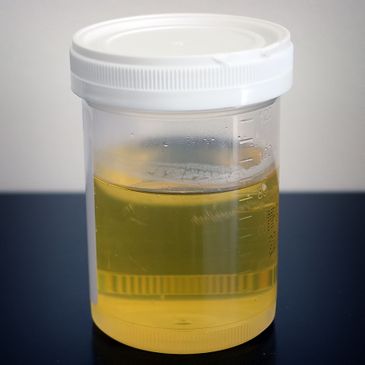 Exame de urina