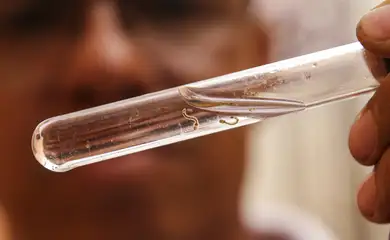 Brasília (DF), 29/02/2024 - Agentes da vigilância ambiental do DF encontram larvas do mosquito transmissor da dengue em residência no Guará, região administrativa do DF. Foto: Marcelo Camargo/Agência Brasil