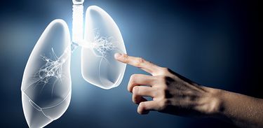 Novembro Branco: mês da prevenção do câncer de pulmão