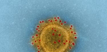 Surto de coronavírus é motivo de prontidão, não de alarde, alertam as autoridades