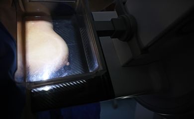 Brasília (DF), 01/10/2024 - Teste de mamografia realizado na Campanha Outubro Rosa: Sesc-DF, que oferece exames e consultas gratuitas às mulheres. Foto: José Cruz/Agência Brasil
