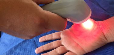 O tratamento Foto Sônico é aplicado nas mãos, mas causa efeito em todo o corpo