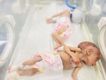 Pascoal registrou imagens chocantes de recém-nascidos subnutridos, na tentativa de denunciar a crise humanitária. (Foto: Reprodução / Pascoal André - ONG PalMed France)