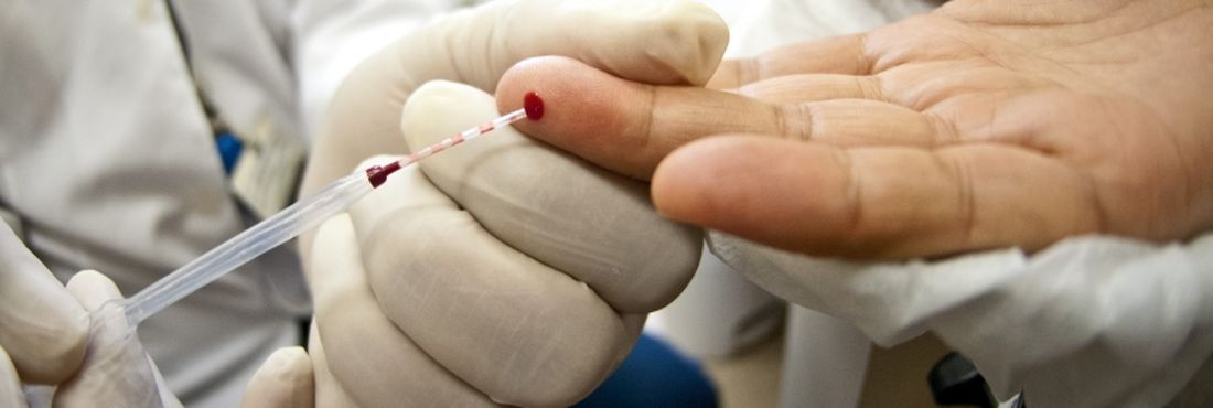 Pelo menos 10% dos paulistas portadores do vírus HIV não sabem que têm a doença, estima a Secretaria da Saúde do estado
