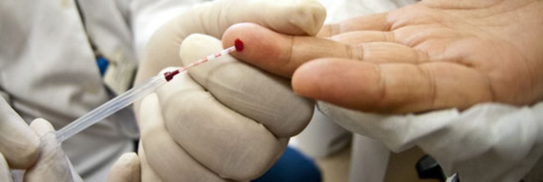 Paciente realizando teste de HIV