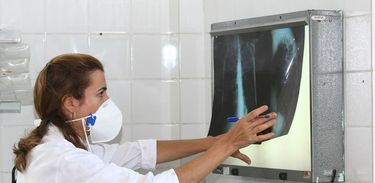 Tuberculose - pulmão