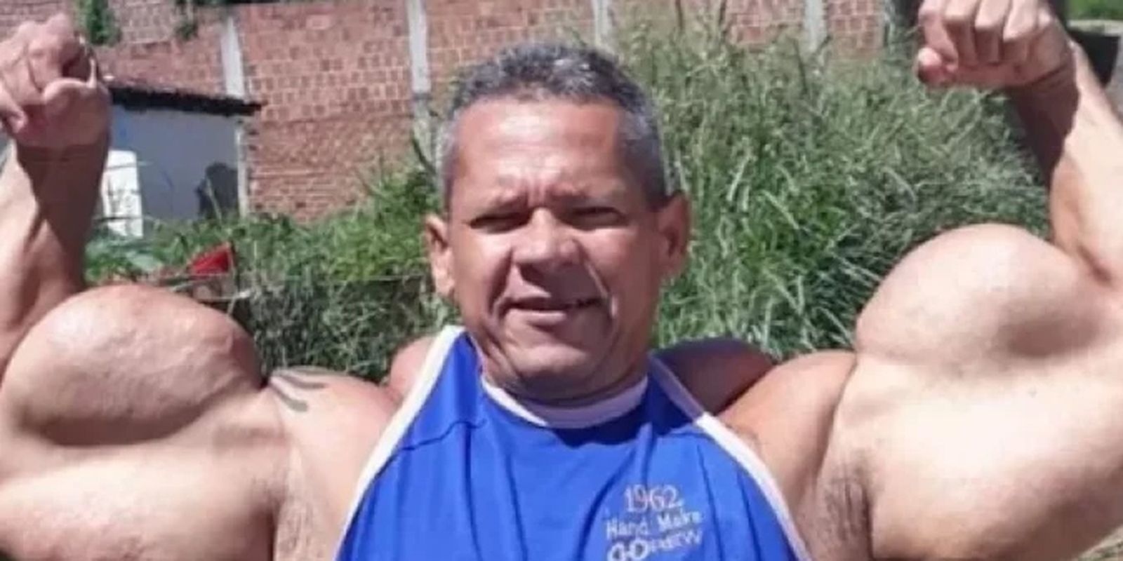 Morre Arlindo de Souza, conhecido como “Popeye Brasileiro”