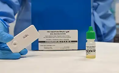 Teste rápido para hantavirose: TR Hantavírus IgM Bio-Manguinhos, com destaque para suporte de teste, apresentando resultado negativo, e frasco com solução reagente. Foto: Rudson Amorim, IOC/Fiocruz
