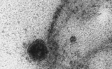microscopia eletrônica; célula  coronavírus; sars-cov-2