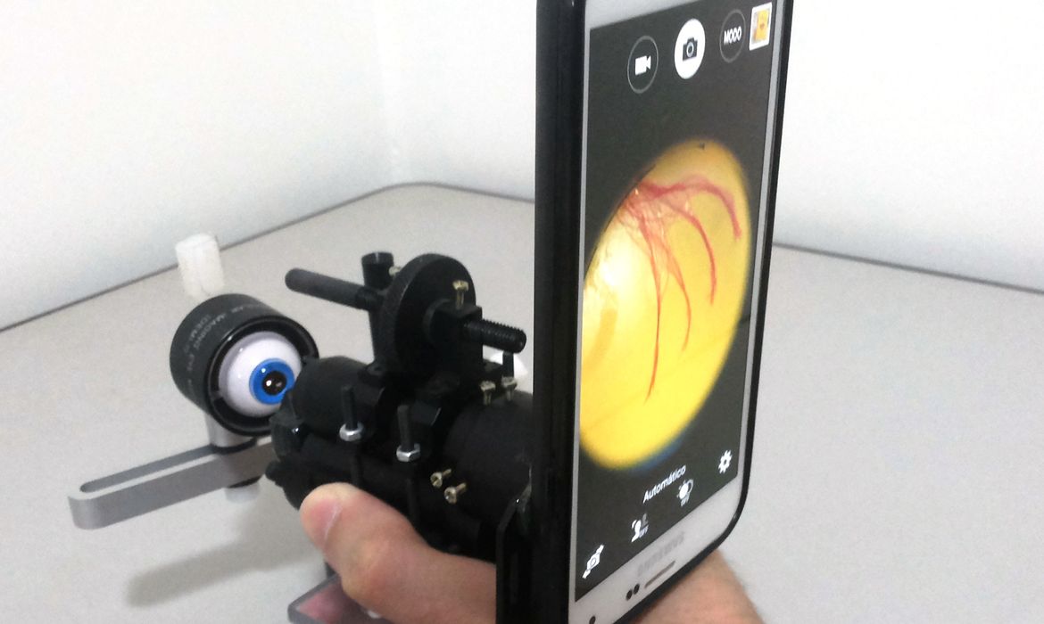 O aparelho consiste em um conjunto ótico e eletrônico que, acoplado a um smartphone de boa qualidade, permite obter imagens de alta resolução do fundo do olho