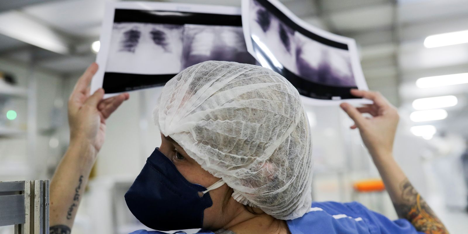 Câncer de pulmão: 15% dos casos acontecem em não fumantes Câncer de pulmão: 15% dos casos acontecem em não fumantes