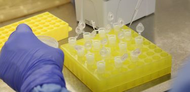 Laboratório da Fiocruz é referência da OMS para coronavírus nas Américas