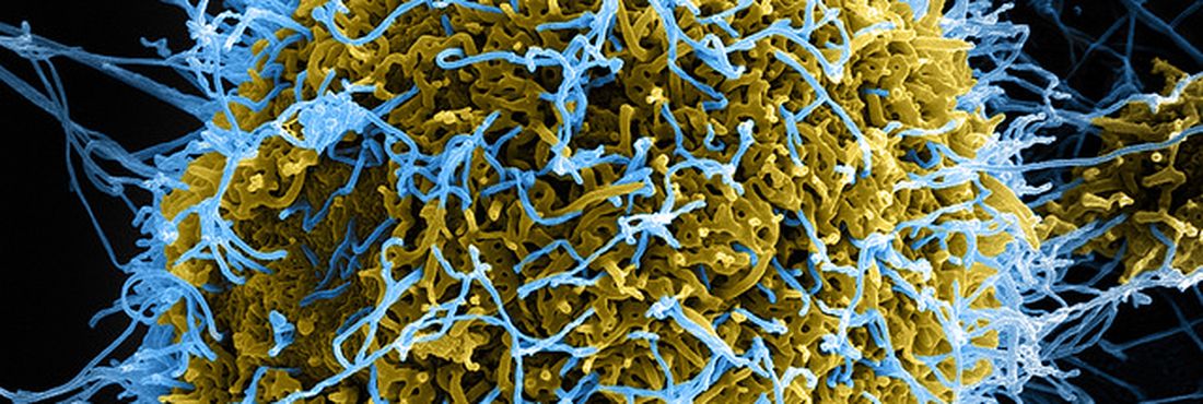 Vírus do ebola Vírus do ebola