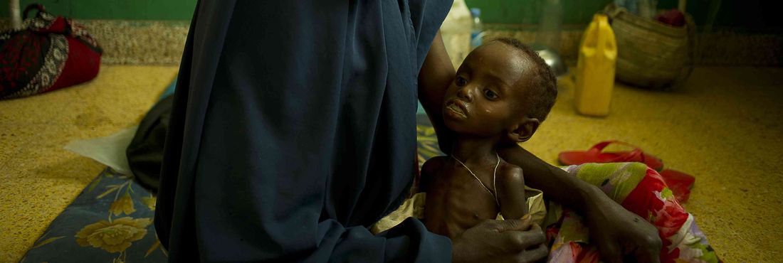 Mãe com criança desnutrida e desidratada é atendida no Hospital Benadir. O país sofre as consequências do conflito armado combinada com longos períodos de seca e fome